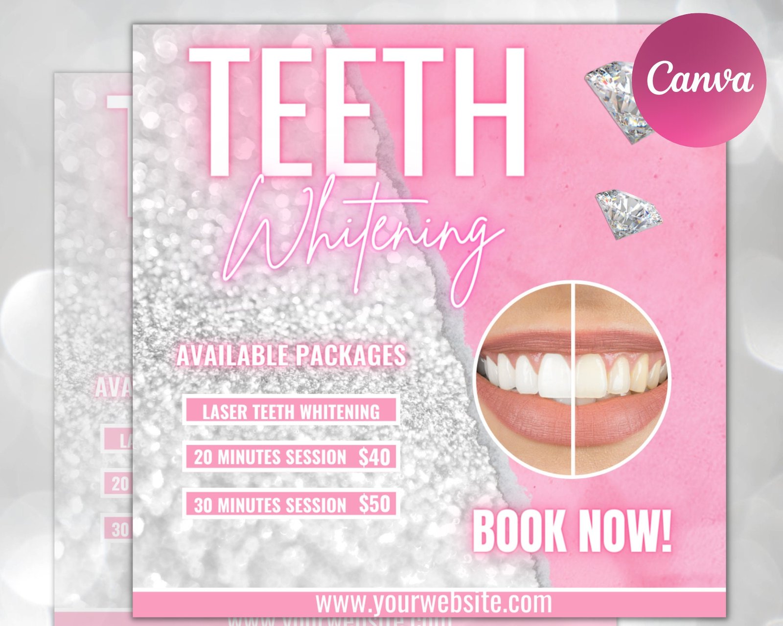 Teeth whitening flyer, diy flyer design template, dentist flyer, teeth whitening classes, teeth whitening training, dentistry flyer design